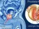 Prostata: neue Erkenntnisse zur Untersuchung und zum PSA-Wert