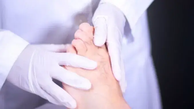 Gicht kommt bei Männern häufiger vor