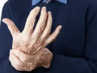 Arthritis: Erste Anzeichen und Symptome bemerken